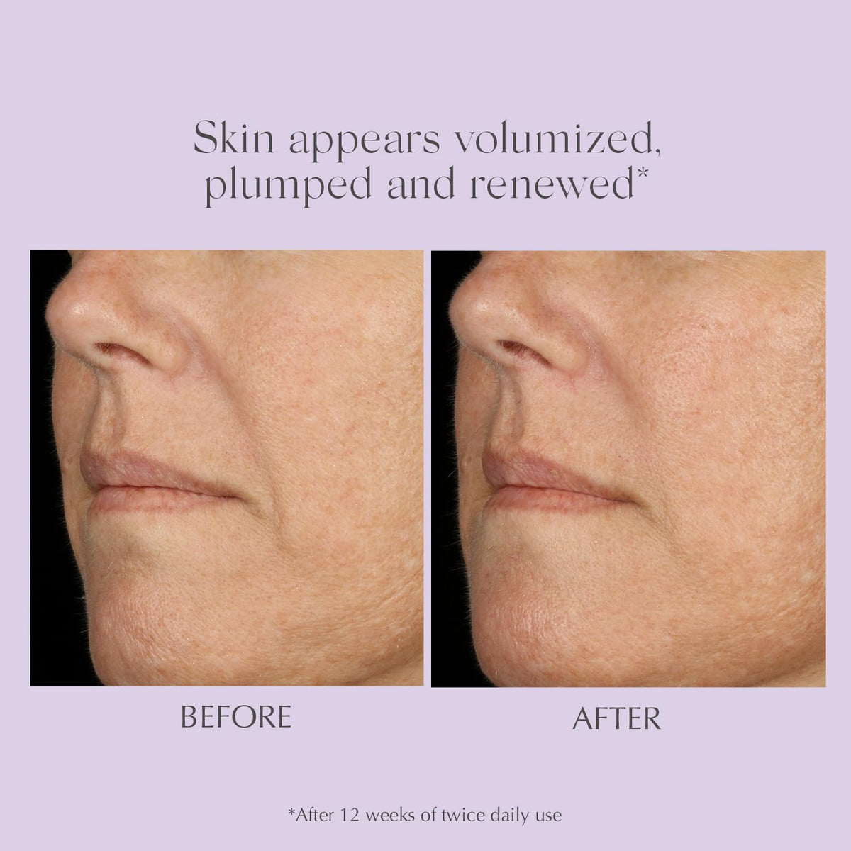 EXUVIANCE Age Reverse hyaluronic acid dropper emphasizing deep hydration