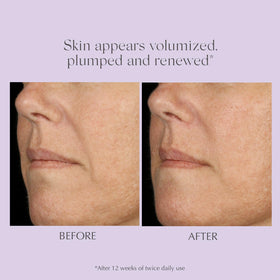 EXUVIANCE Age Reverse hyaluronic acid dropper emphasizing deep hydration