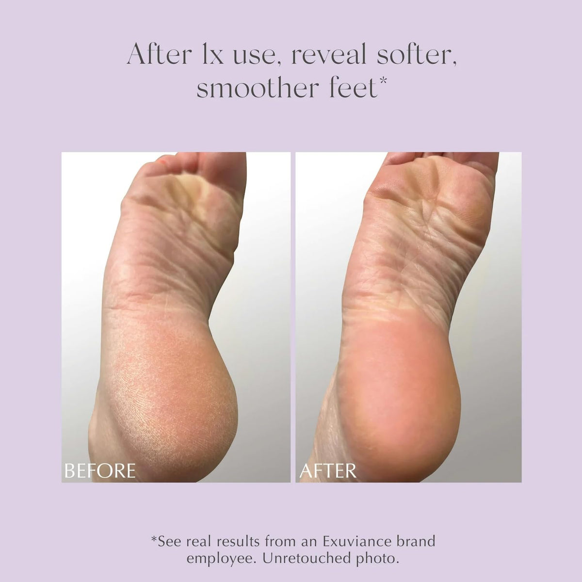 EXUVIANCE foot balm with a non-greasy texture