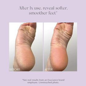EXUVIANCE foot balm with a non-greasy texture