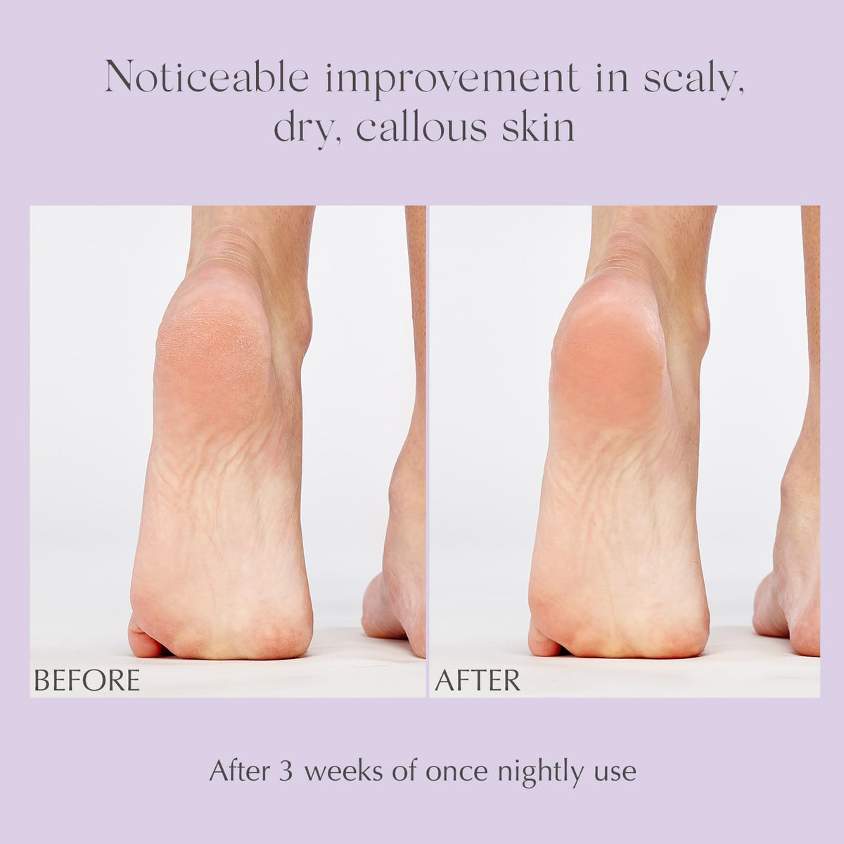EXUVIANCE foot balm provides Vitamin E hydration for feet