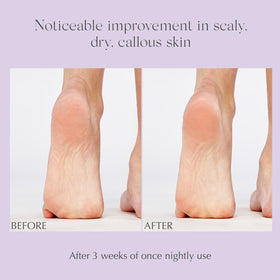 EXUVIANCE foot balm provides Vitamin E hydration for feet
