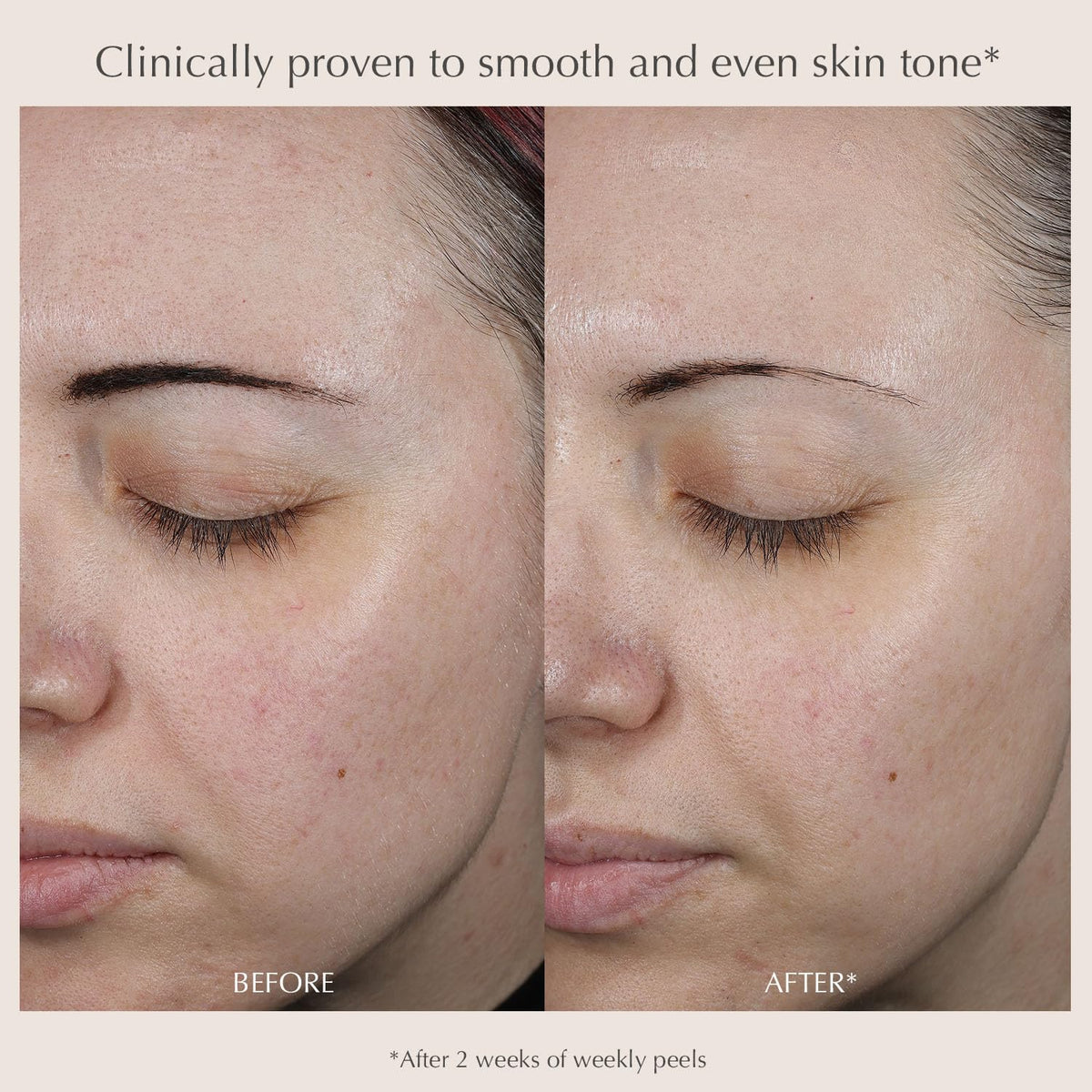 EXUVIANCE Performance Peel AP25 pads arranged for an easy routine.