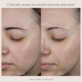 EXUVIANCE Performance Peel AP25 pads arranged for an easy routine.