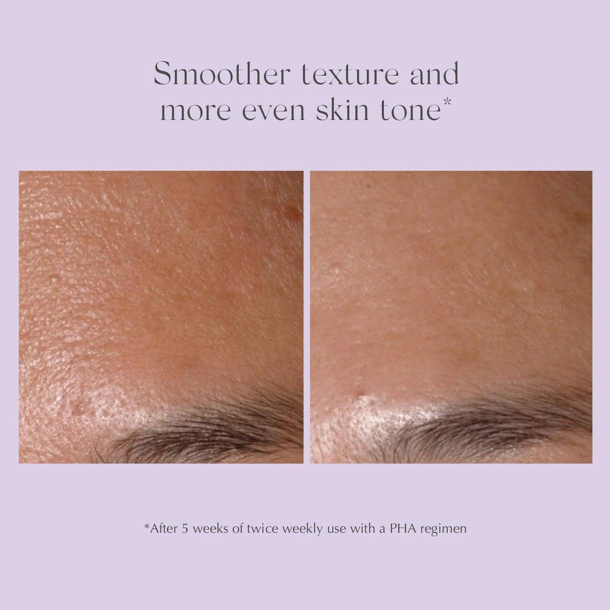EXUVIANCE starter set weekly-use visuals suggest mild, controlled exfoliation routine