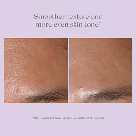 EXUVIANCE starter set weekly-use visuals suggest mild, controlled exfoliation routine