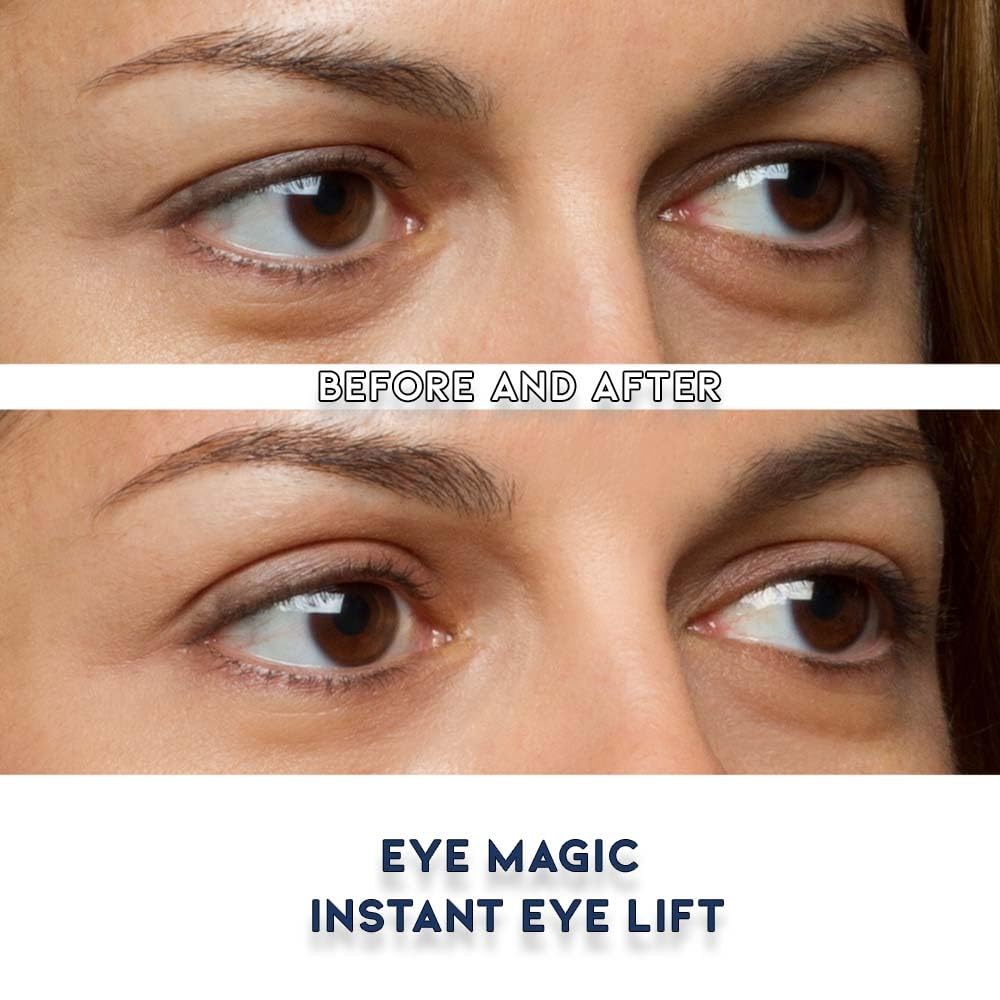 Eye Magic strips for droopy eyelids offer discreet support and lift.