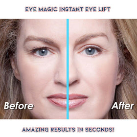 Eye Magic strips for hooded eyelids provide a subtle, lifting effect.