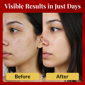 FACEDOCTOR Complexion Bar Soap sea buckthorn oil detail highlights nourishing, natural ingredients.