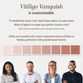 Fake Bake Vitiligo Vanquish color drops demonstrate darkening and toning adjustments for natural blending