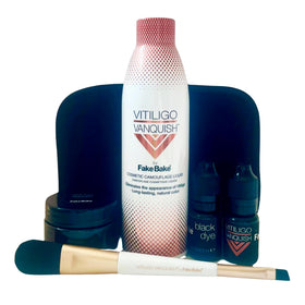Fake Bake Vitiligo Vanquish swatches showcase color matching options for all skin tones