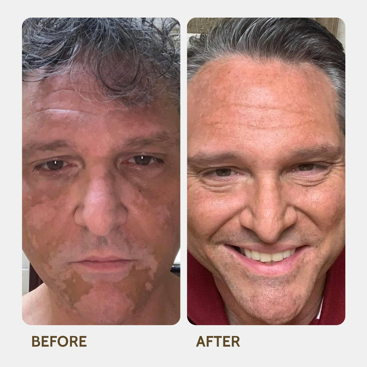 Fake Bake Vitiligo Vanquish natural coverage provides a subtle, skin-like finish