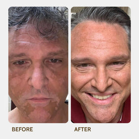 Fake Bake Vitiligo Vanquish natural coverage provides a subtle, skin-like finish