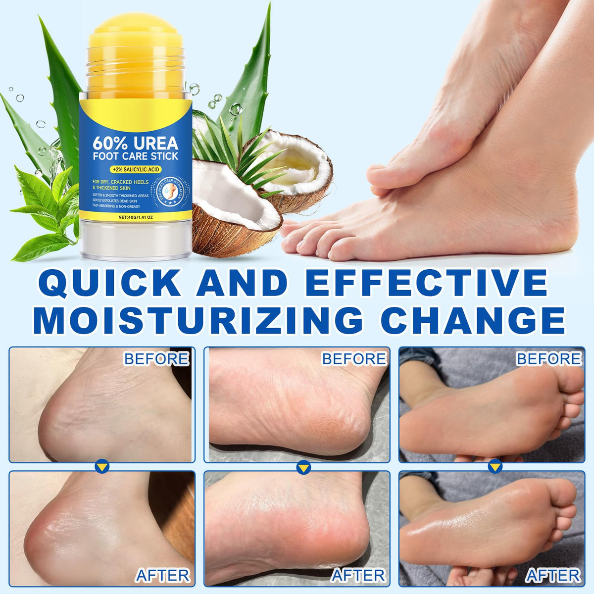 Gentle exfoliation and hydration with Fanshi Urea Stick
