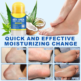 Gentle exfoliation and hydration with Fanshi Urea Stick