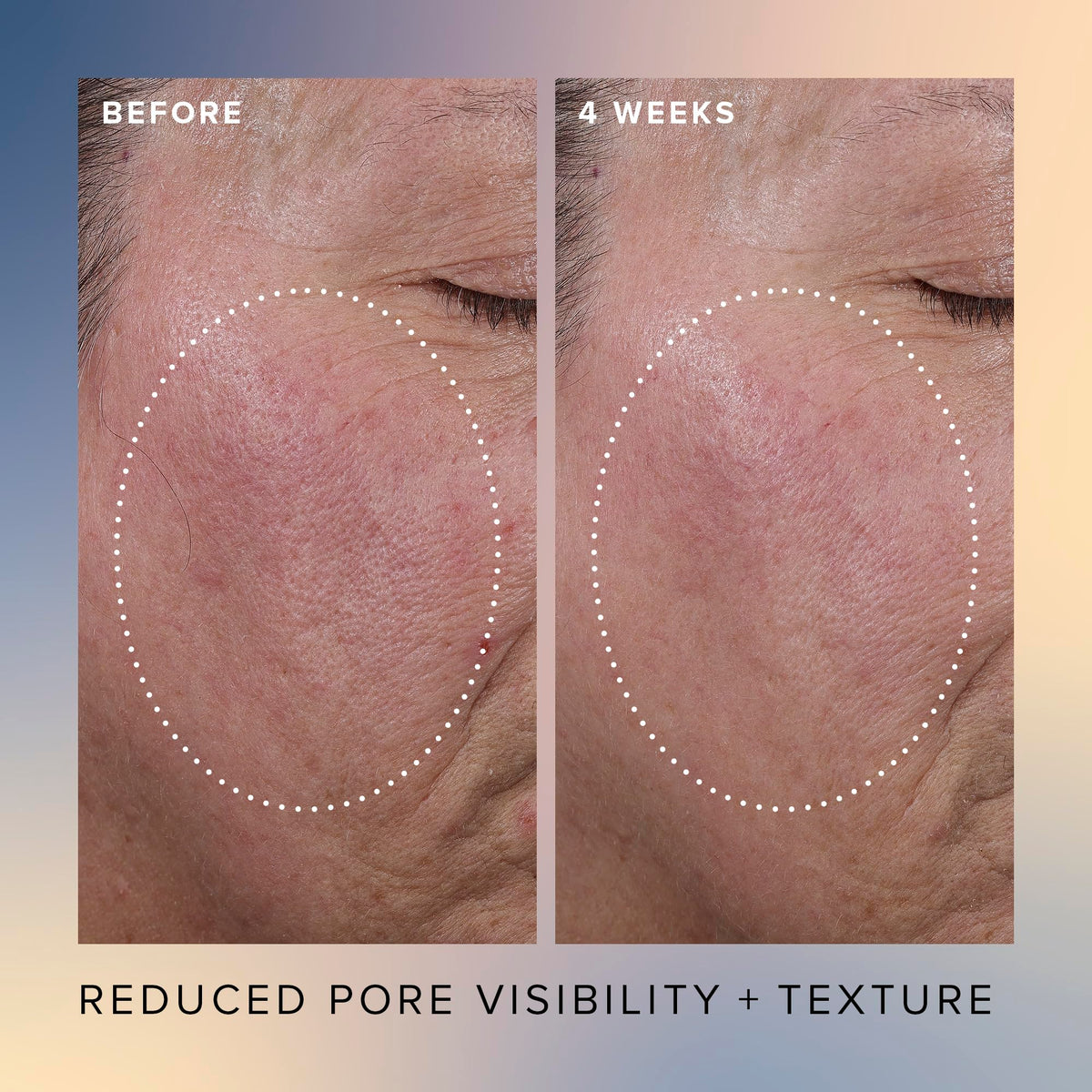 Silky texture swirl conveys light, hydrating exfoliant for the skin