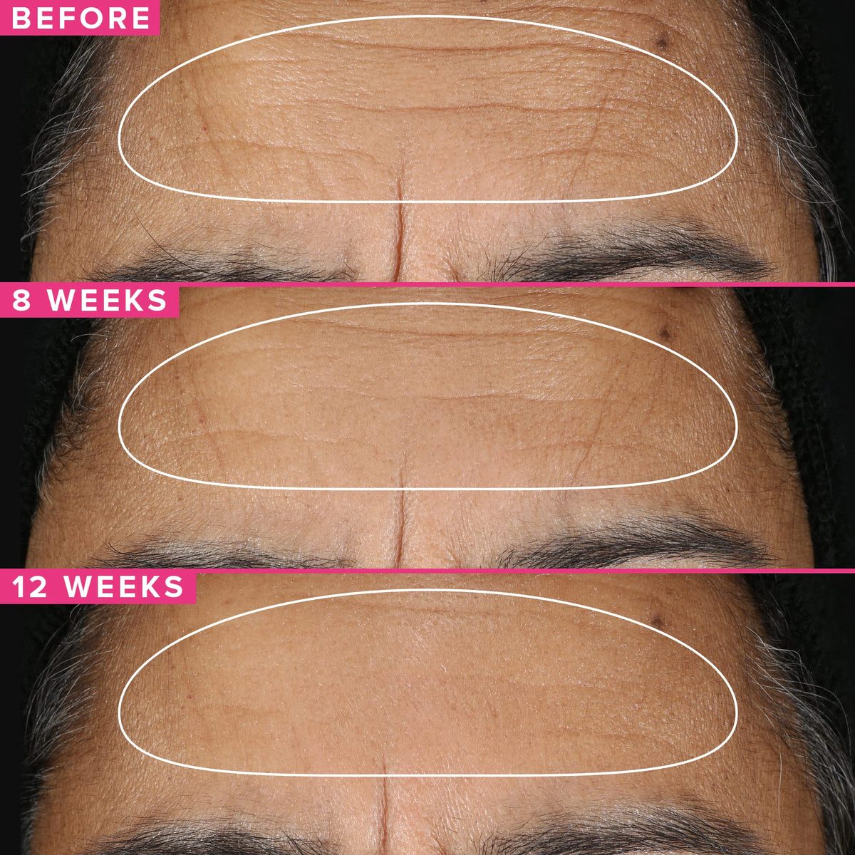 Farmacy Retinol Serum encapsulated retinol detail suggesting deeper delivery.