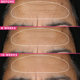 Farmacy Retinol Serum encapsulated retinol detail suggesting deeper delivery.