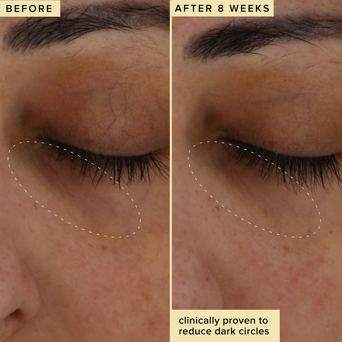 Farmacy Wake Up Honey Eye Cream hyaluronic acid provides instant hydration