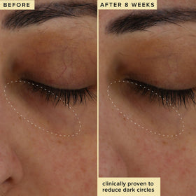 Farmacy Wake Up Honey Eye Cream hyaluronic acid provides instant hydration