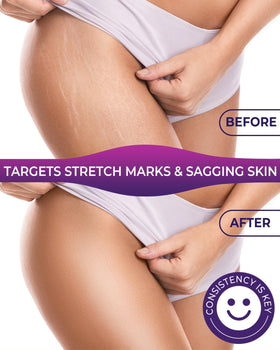 Texture on skin from FeeMeFee Body Firming Oil demonstrates quick-absorbing, non-greasy finish