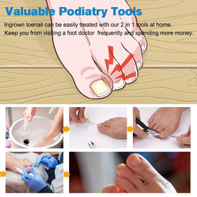 FERYES nail trimming kit ready for at-home care.