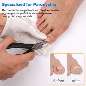 FERYES thick-nail cutting jaw demonstrates robust cutting capability.