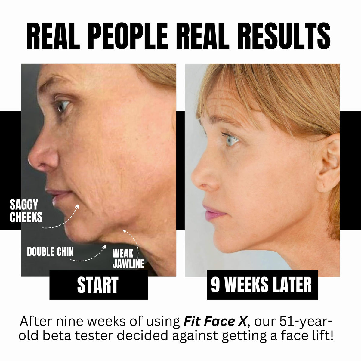 FFX Cheek X exerciser for lifted and sculpted cheeks