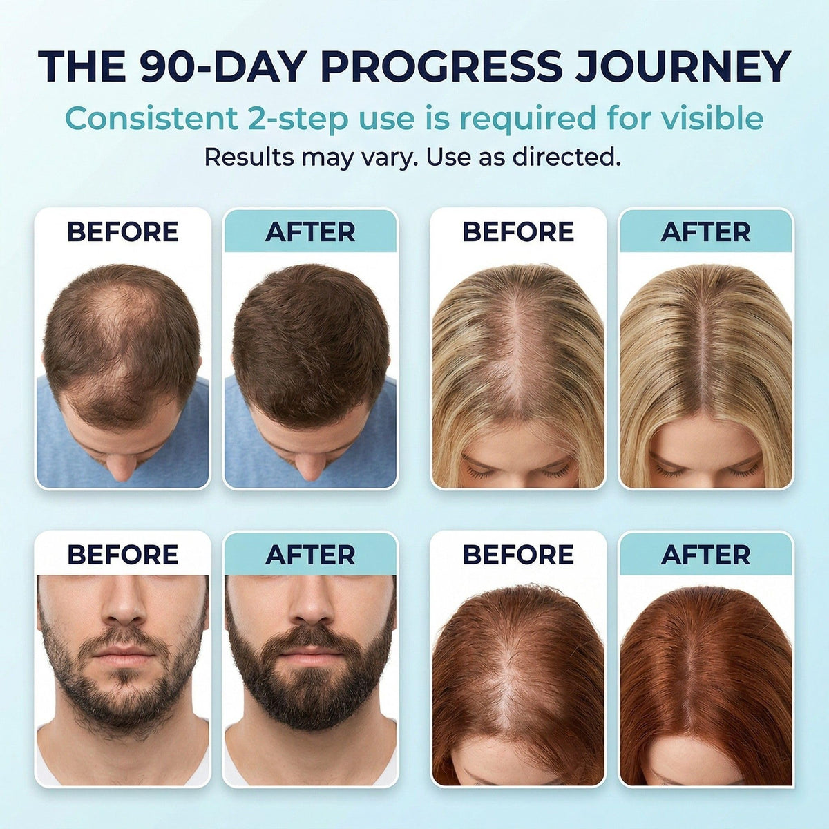 Fiimiu Minoxidil Foam application on scalp showing quick absorption.