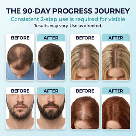 Fiimiu Minoxidil Foam application on scalp showing quick absorption.