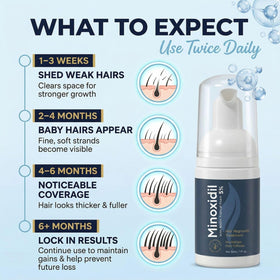 Fiimiu Minoxidil Foam travel-size can, TSA-friendly for travel.