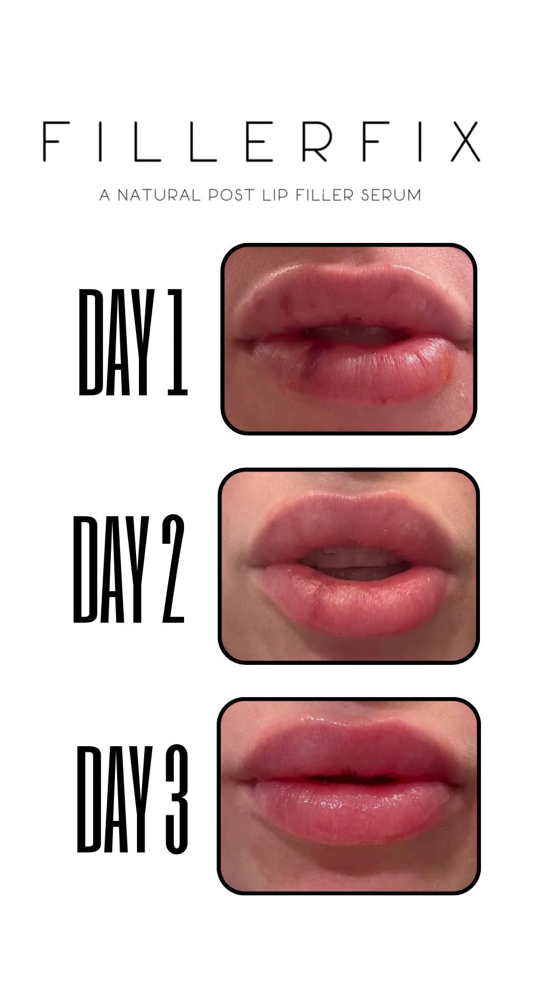 FillerFix preservative-free lip balm designed for freshness and long-lasting care.