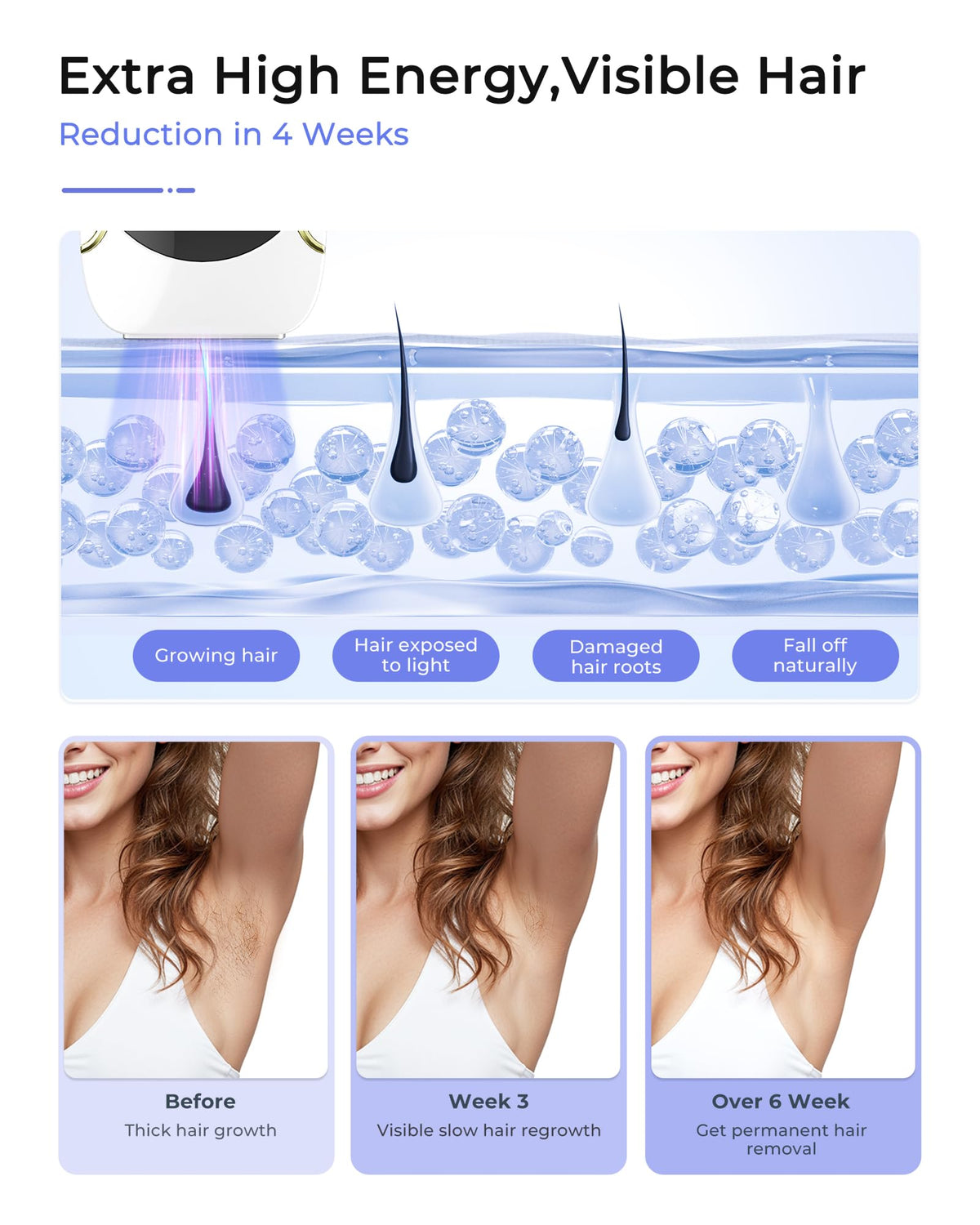 Finequin Air 15 skin sensor ensures safe, precise IPL flashes.