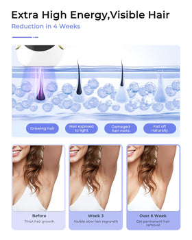 Finequin Air 15 skin sensor ensures safe, precise IPL flashes.