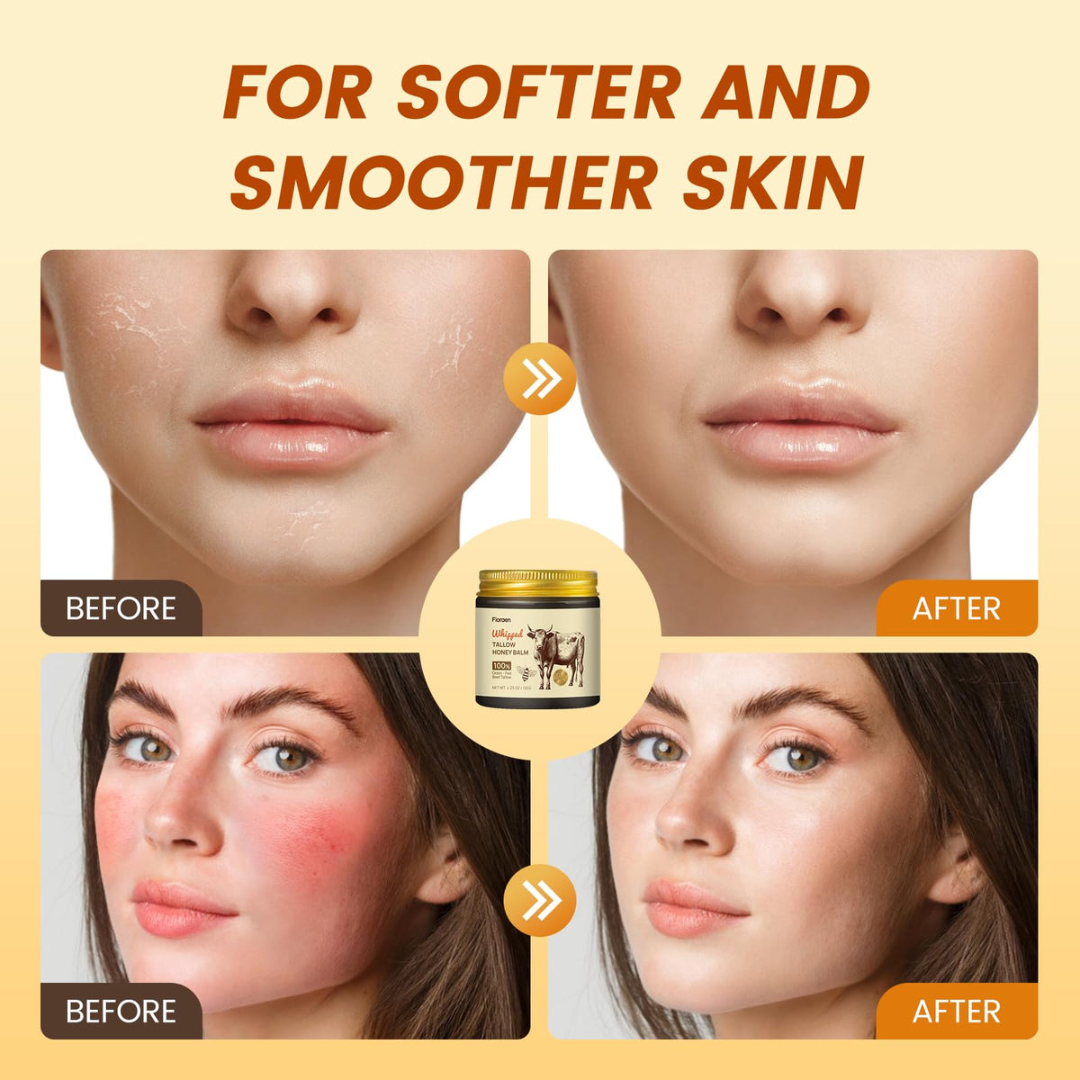 Fioraen balm used on dry sensitive skin areas like elbows and hands