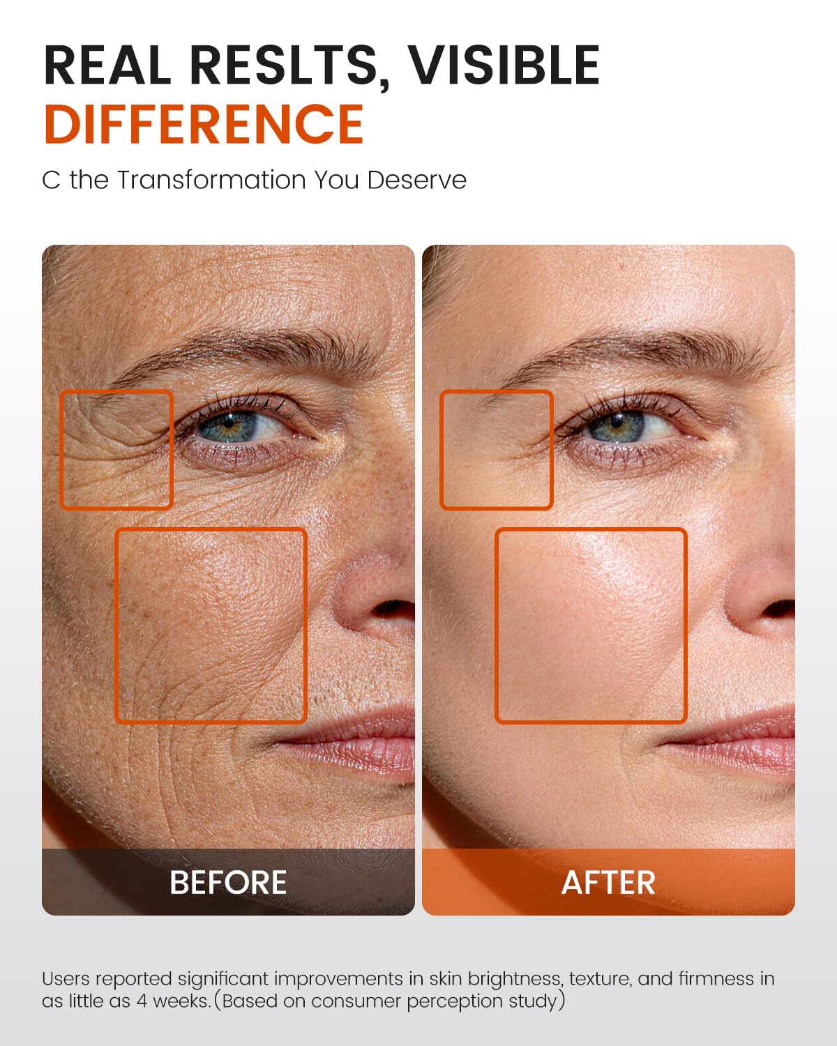 Fioraen Super C Serum with retinol-ferulic-acid synergy close-up.