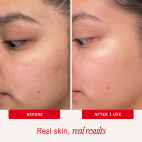 First Aid Beauty Brighten Glow Pad removes impurities for clearer, calmer skin.