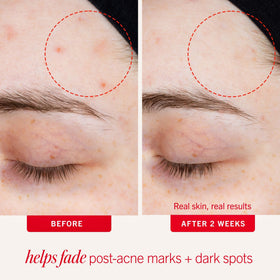 Closeup of First Aid Beauty Lactic Lotion texture with breathable, fast-absorbing finish