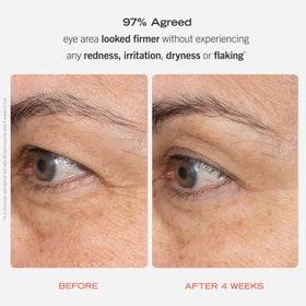 First Aid Beauty Retinol Eye Cream swatch on skin, visible smoothing of fine lines.