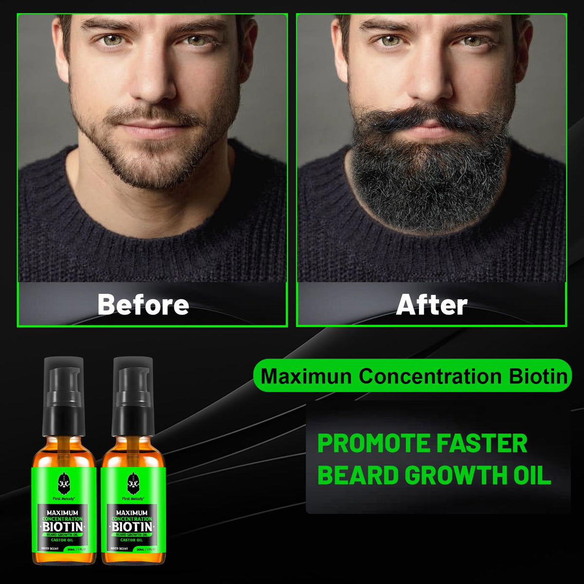First Melody Beard Oil dropper ready for precise, even application