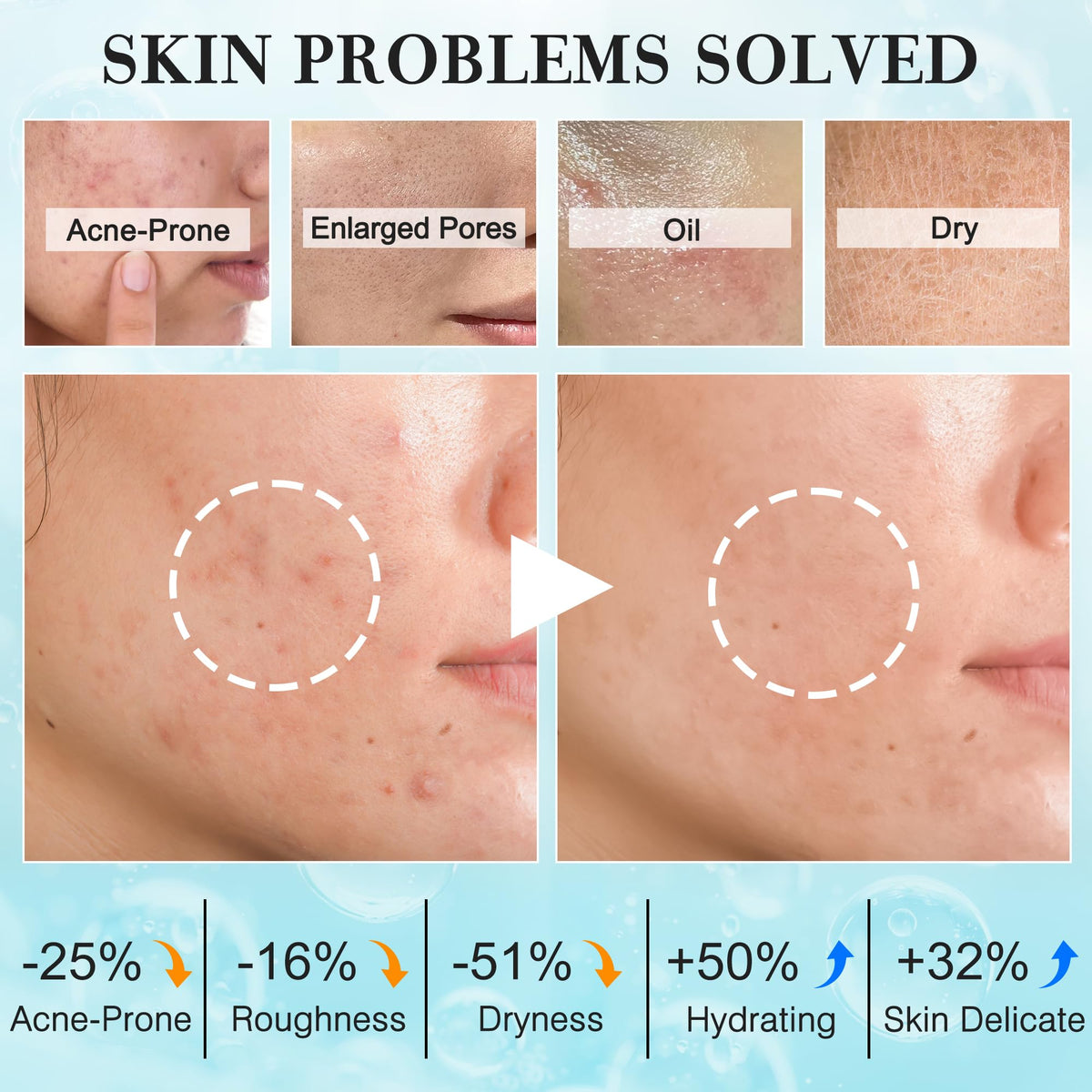 FITOEG serum dropper highlighting light hydration for teen and adult skin