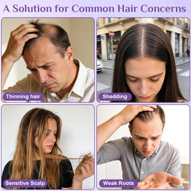 Fleird precision roller applying serum to thinning spots on the scalp.
