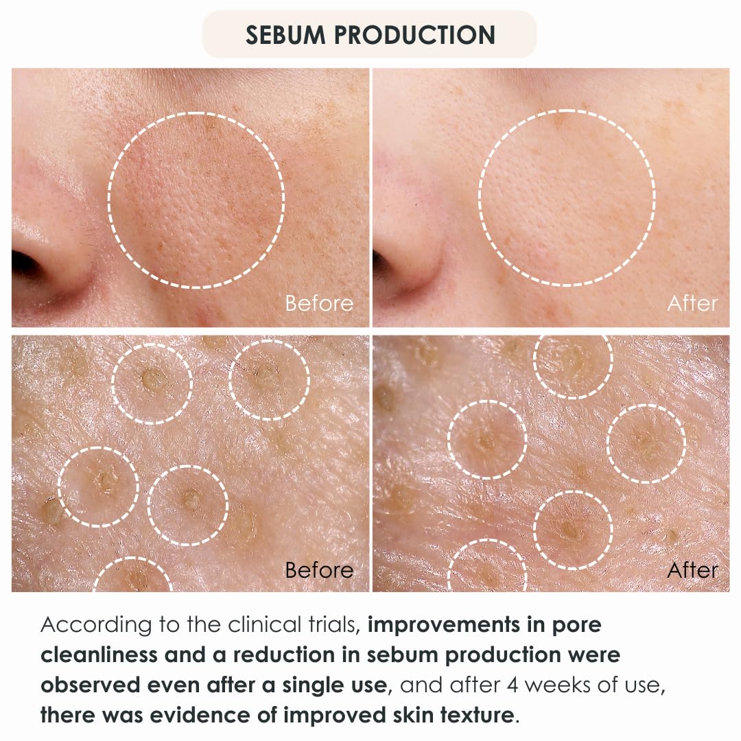 Fleuri Clear Gel Cleanse lather application on skin for cleansing