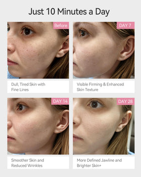FliKEZE vacuum lift technology close-up showing gentle suction for contour refinement.