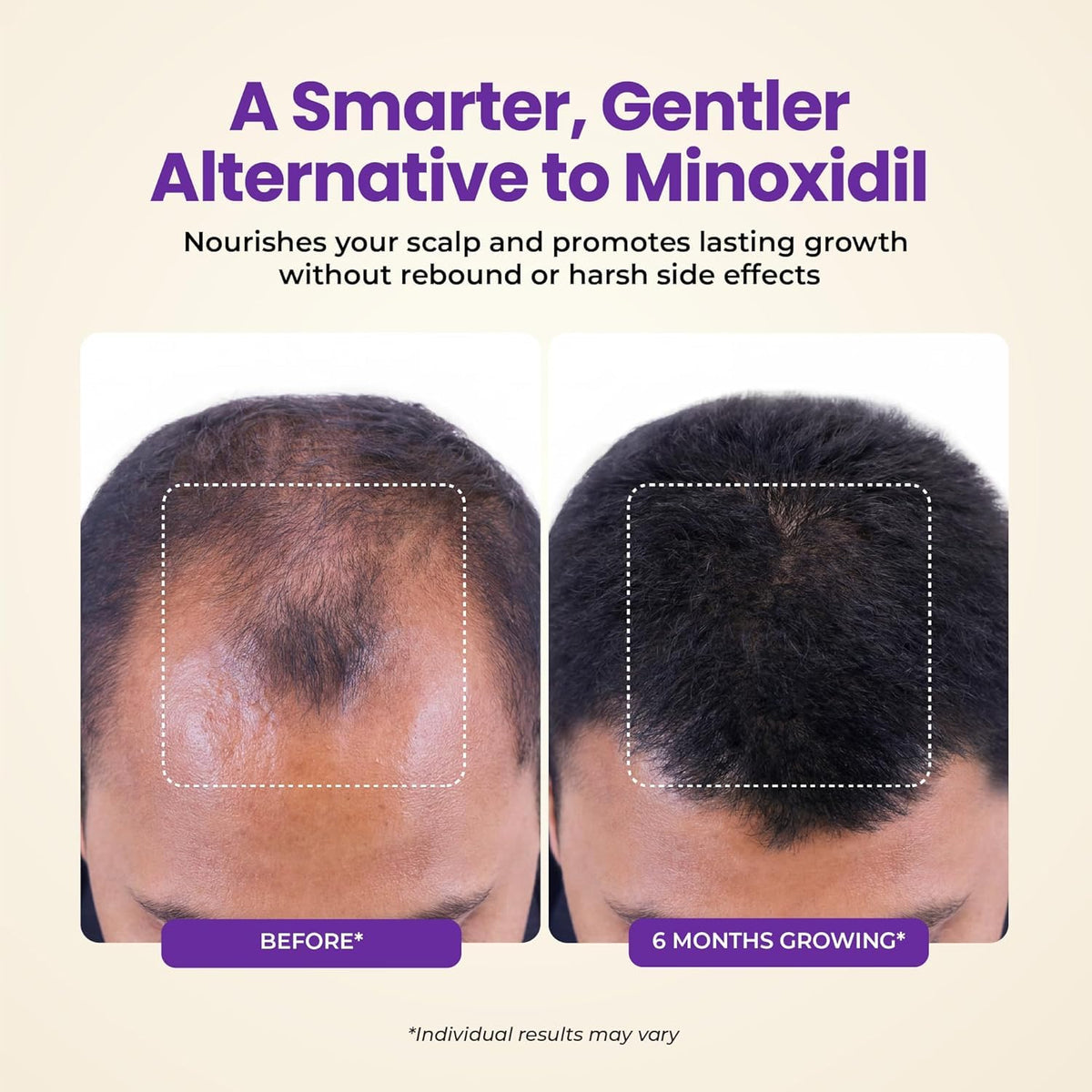 FOLICARE serum applied to scalp showing fast absorption action.