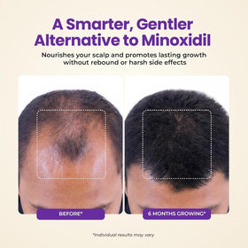 FOLICARE serum applied to scalp showing fast absorption action.