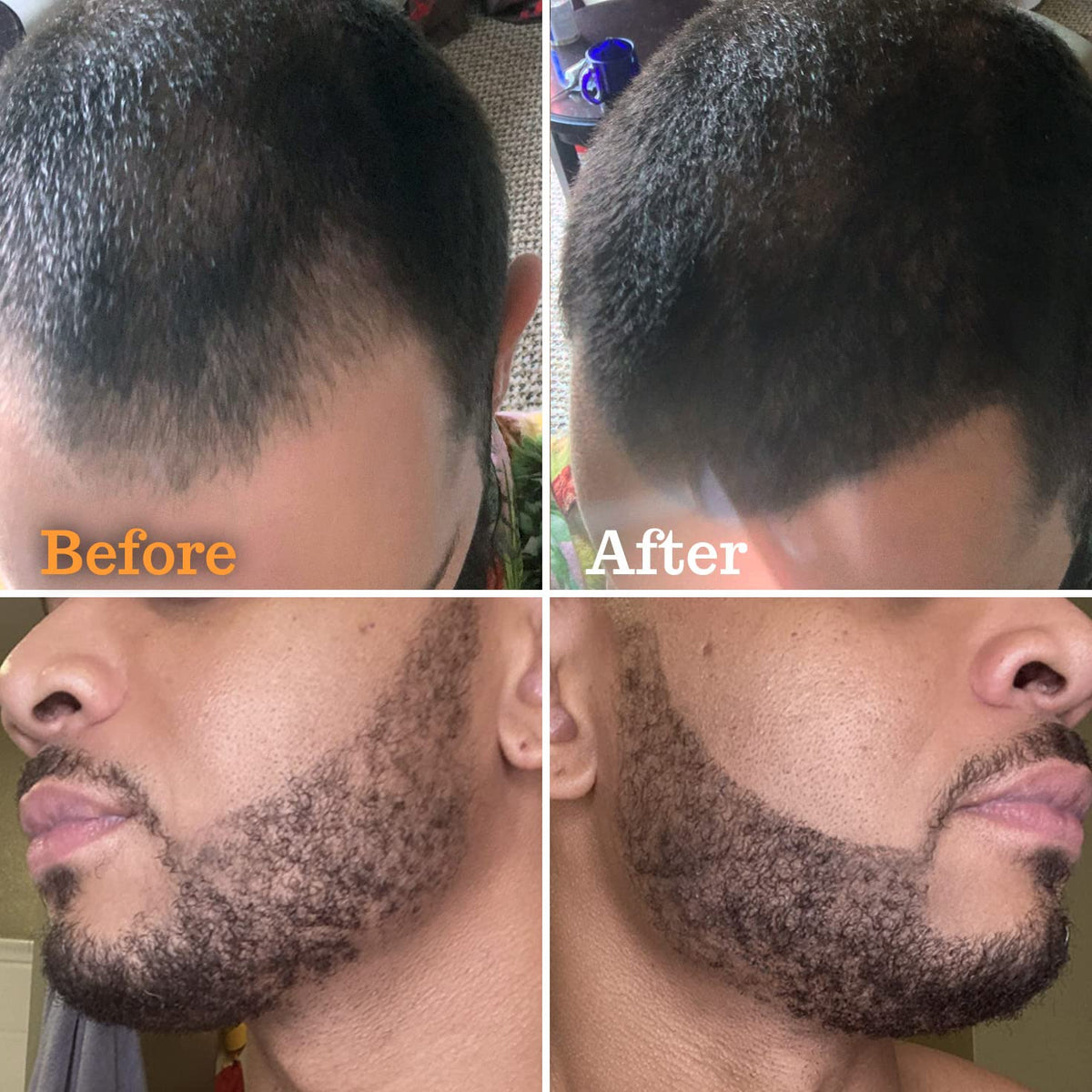 Follicle Booster Beard Brush Styling Kit for quick grooming and even distribution.