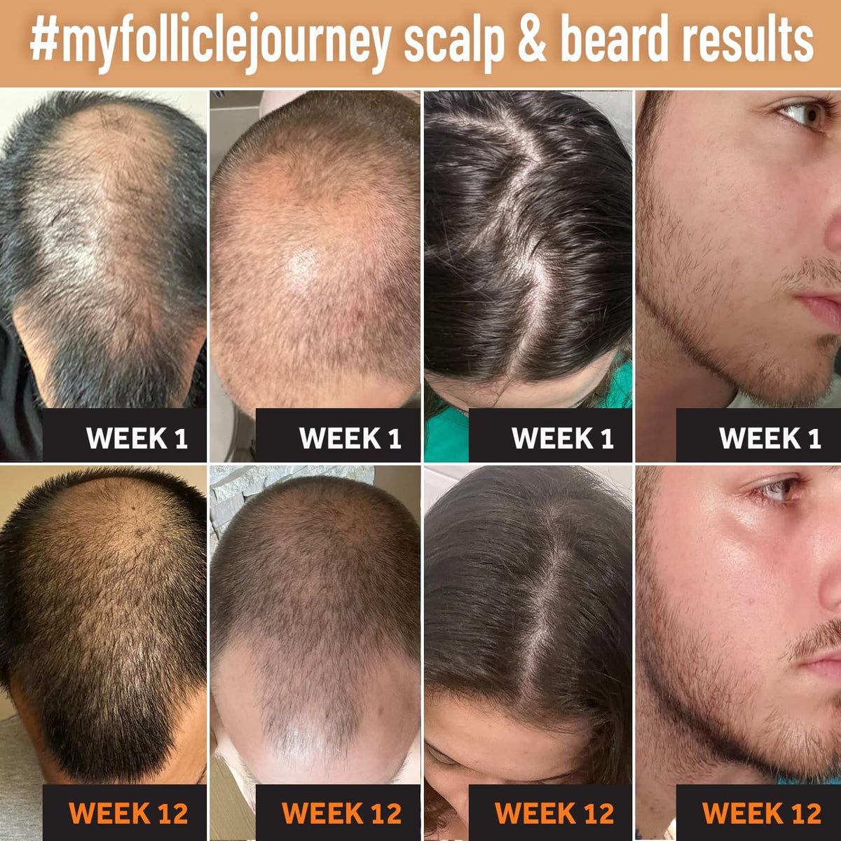 Follicle Booster biotin conditioner label close-up highlights nourishing oils.