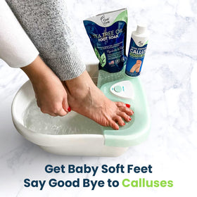 FOOT CURE Softened calluses close-up after soak and gel treatment