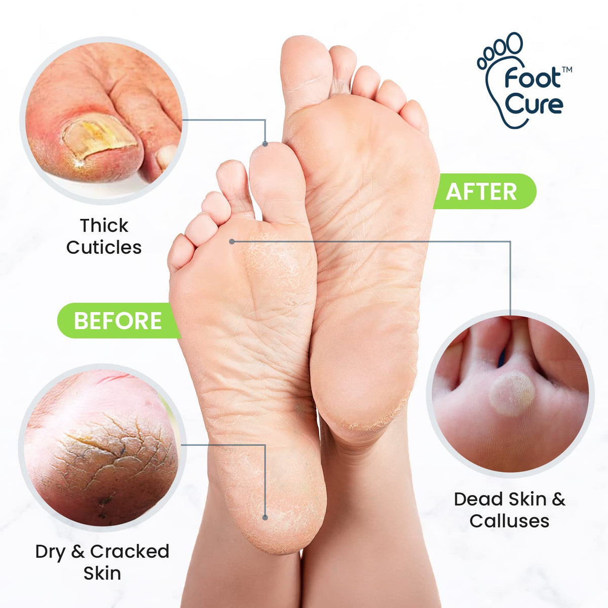 FOOT CURE Tea Tree Foot Soak ingredients close-up highlighting natural oils